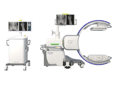 什么是移動(dòng)式三維C形臂？它的臨床優(yōu)勢(shì)體現(xiàn)在哪？