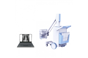 移動(dòng)式攝影X射線機(jī)PLX5100 移動(dòng)式攝影X射線機(jī)PLX5100