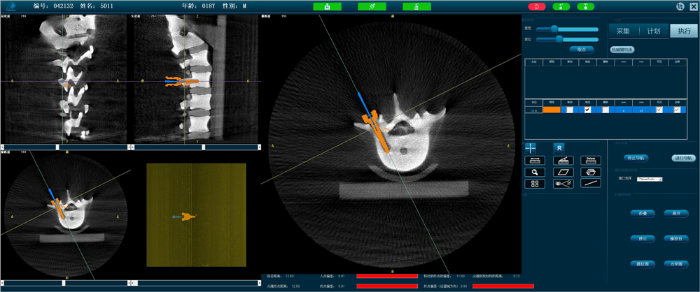 天權(quán)骨科手術(shù)機(jī)器人-準(zhǔn)確定位 天權(quán)骨科手術(shù)機(jī)器人-準(zhǔn)確定位