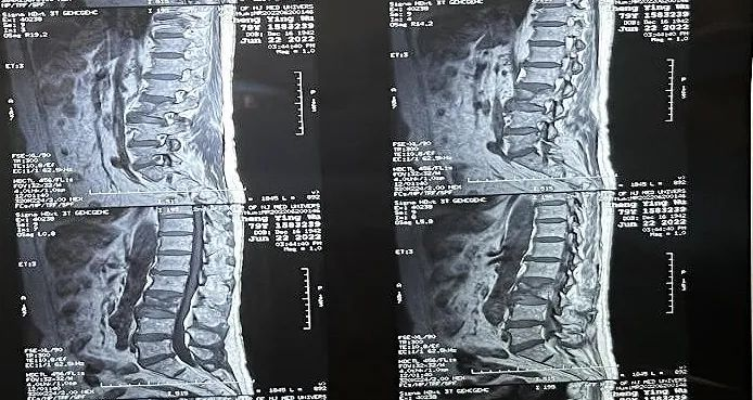 大平板C臂機-術(shù)前影像 大平板C臂機-術(shù)前影像