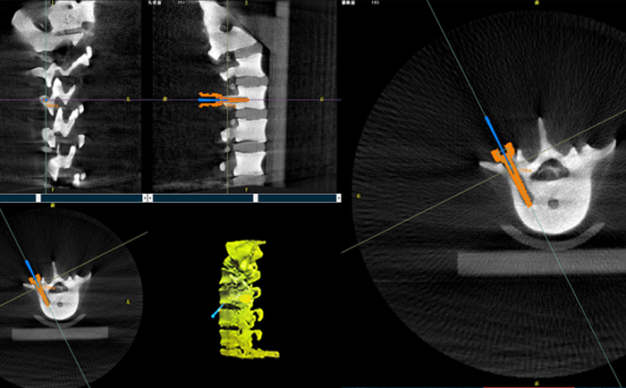 機(jī)器人手術(shù)系統(tǒng)3D影像