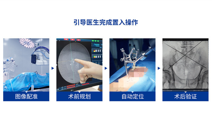 手術(shù)機(jī)器人優(yōu)點(diǎn) 手術(shù)機(jī)器人優(yōu)點(diǎn)