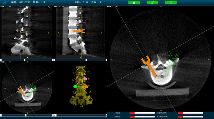 機器人手術(shù)系統(tǒng)3D影像 機器人手術(shù)系統(tǒng)3D影像