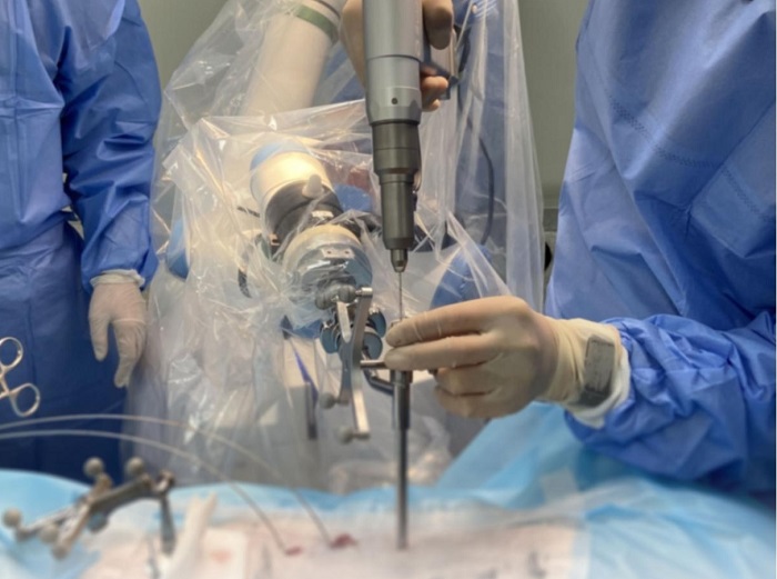 脊柱外科手術導航定位系統(tǒng)